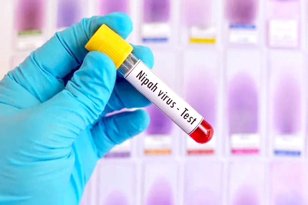 Two suspected Nipah cases raise concerns in three districts, alert issued.